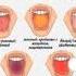 The Color Of Your Tongue Will Tell You About Your Health Rek Shorts Health And Beauty здоровье ем