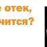 Липедема это не отек не ожирение лечится Обсуждаем разбираем 6 случаев