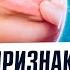 Когда дефицит витаминов налицо А В В1 В17 С Д Е К К1 К2 Вот все причины