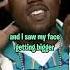 Kanye West Talks About Breaking His Jaw