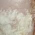 Keratin Granulations White Toenails Best Home Treatment
