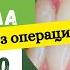 Как я остановила рецессию десны без операции 4 минуты в день и десны стали возвращаться на место