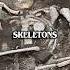 This Guy Found A Vampire Skeleton