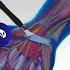 Carpel Tunnel Surgery See How It Is Fixed Carpaltunnelsyndrome Chronicpain