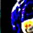 Triple Trouble Zoe LBP Sonic Section Kaizo Mix