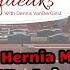 Hernia Mesh Lawsuit We Ask Our Experts Legal Squeaks Episode 014