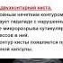 УЗИ Доктор Иогансен Выпуск 20 Эхинококковые поражения печени Часть 2