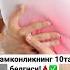 камконликнинг белгилари