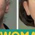 Facial Hair Stops Woman From Dating The Bad Skin Clinic