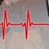 Subnautica Below Zero But I M Wearing A Heart Monitor