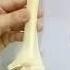 HUMERUS GENERAL FEATURES BY DR MITESH DAVE