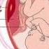 Obstetric Antepartum Haemorrhage