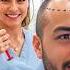 I Went Bald So I Flew To Türkiye To Fix It