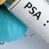 What Is A PSA Test Prostate Specic Antigen