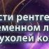 Чикризов С И Возможности рентгенотерапии в современном лечении опухолей кожи