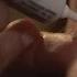 Medicine Management How To Administer Eye Ointment