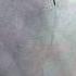 Rotablation Angioplasty Of A Calcified Widow Maker S Artery Dr Binoy John Still More Rota