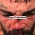 Mike Perry Talks Nose Injury Vs Luque