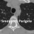 SAPHO Syndrome CT Chest