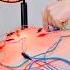 ASMR Chinese ELECTRIC Acupuncture Chiropractic Cupping And Massage Totally Fixed Me