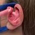 Billsmafia For The Win Earimpression Satisfying Earwax Audiologist Audiology Earwaxremoval