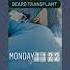 Beard Transplant By AIIMS Delhi Dermatologist Dr Prateek Sondhi