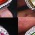 GEMSTONES UPDATE 02112024 CATS EYE RAINBOW SCAPOLITE RUBY BURMA MORGANITE EMERALD HESSONITE PERIDOT