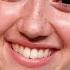 ASMR Friend Does Your Skincare Fast Aggressive Layered Sounds
