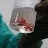 Incomplete Abortion Hysteroscopic Removal Of Products Dr Rhythm Gupta IVF Specialist In Delhi