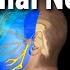 Trigeminal Neuralgia Tic Douloureux Animation