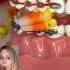 JUNKFOOD You CAN Eat With BRACES ORTHODONTIST Reacts To Satisfying Candy Shorts Braces Asmr