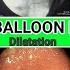 Duodenal Balloon Dilatation At SQUARE HOSPITAL LTD Dhaka Bangladesh BD ENDOSCOPY