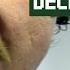 I Am Declaring War On STRESS Denholm The IT Crowd Series 1 Episode 2