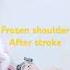 Frozen Shoulder Best Shoulder Exercises For Post Stroke Patients