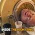 This Man Has Lived Inside The Iron Lung Machine For 65 Years