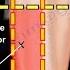 Vastus Lateralis Intramuscular Injection Everything You Need To Know Dr Nabil Ebraheim