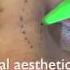 Rhinoplasty Surface Aesthetics And Surgical Techniques